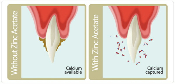 フォーキャンス